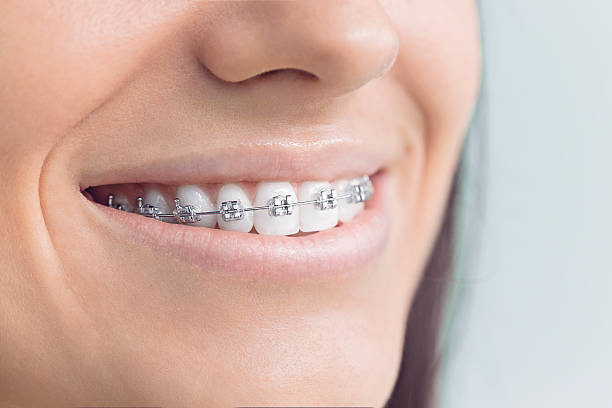 Best Traditional Braces  in Zeigler, IL